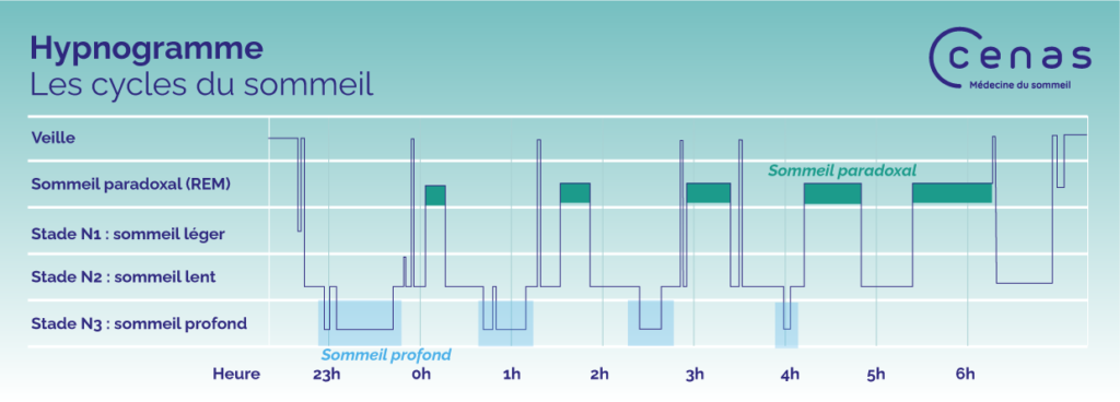 Sommeil Lent, Profond Et Paradoxal : Comprendre Les Différentes Phases ...